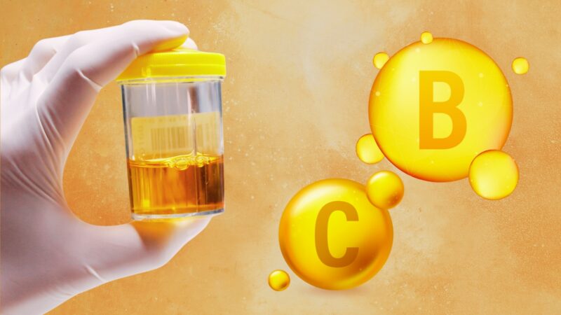 Vitamin B-Complex and Vitamin C Can Change Urine Color