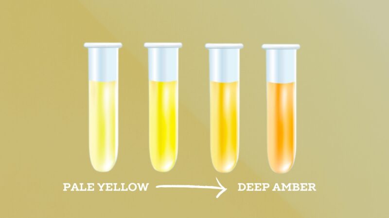 Normal Urine Color Spectrum