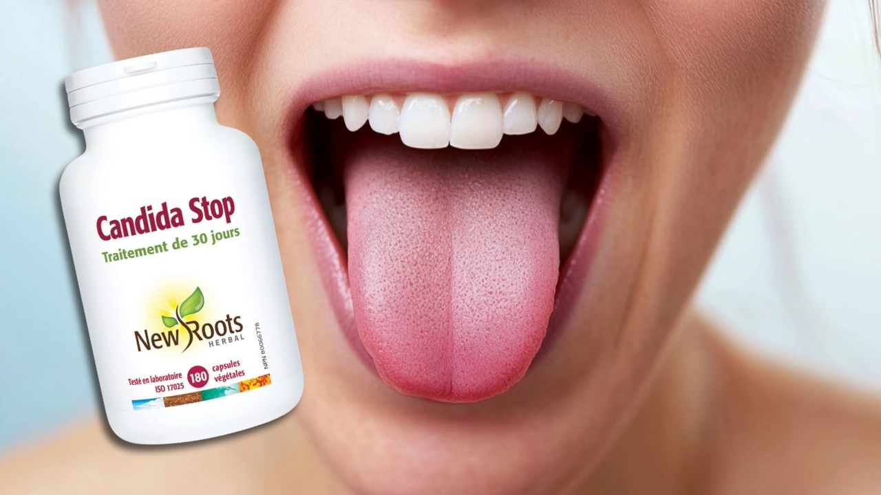 Close-up image of a person's open mouth showing their tongue, next to a bottle of New Roots Candida Stop, which contains 180 capsules for a 30-day treatment