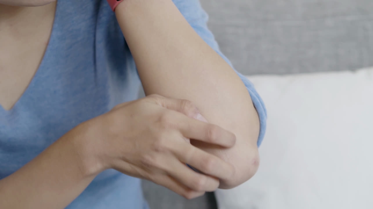 A girl is scratching her arm due to dry skin